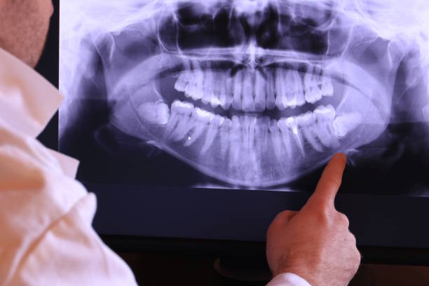 Best Emergency Root Canal Treatment in Powers Lake, WI